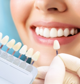 Porcelain Veneers 2 , cosmetic dentistry services at The Smile Collective Dental Clinics