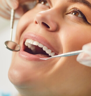 Dental check-up & clean, model 1, The Smile Collective