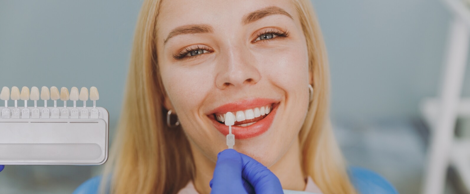 Porcelain veneers blog, model 1-2