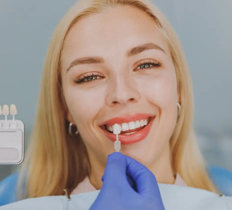 Porcelain veneers blog, model 1