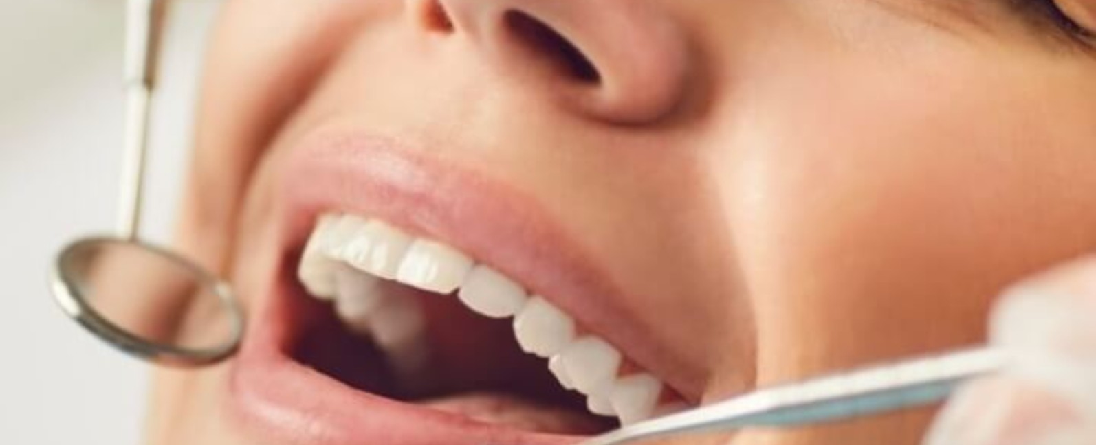 Dentist examining a patient’s teeth and gums with a mirror and probe, gum disease blog 1